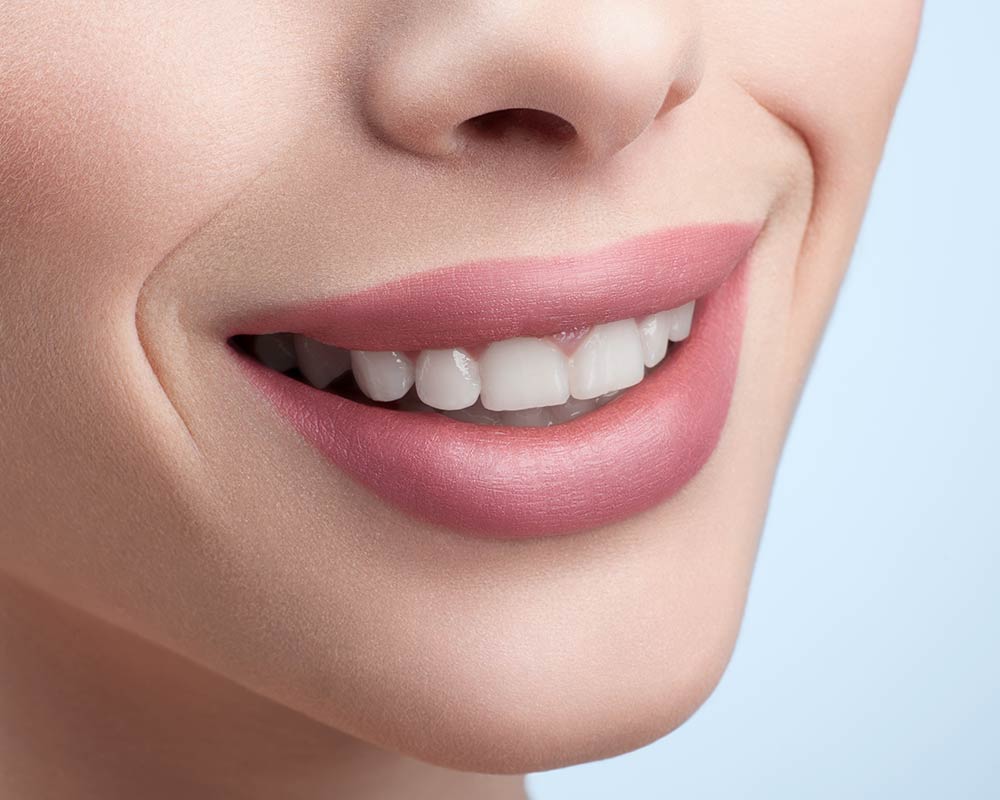 Teeth Whitening Cork - Cosmetic Dental Treatments Cork City Dentist