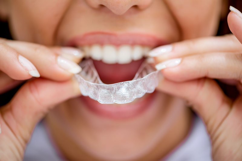What Can Invisalign Treat Cork City Dentist